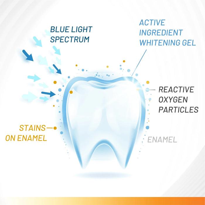 White Glo Accelerator Teeth Whitening Kit